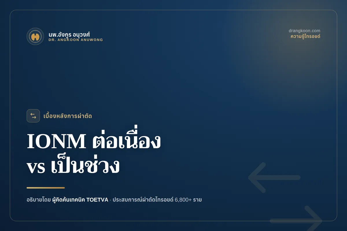 เปรียบเทียบ C-IONM แบบต่อเนื่องกับ I-IONM แบบเป็นช่วงในการติดตามเส้นประสาทระหว่างผ่าตัดไทรอยด์