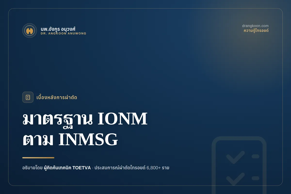หน้าจอเครื่อง IONM แสดงลำดับการตรวจเส้นประสาท V1 R1 R2 V2 ตามมาตรฐาน INMSG