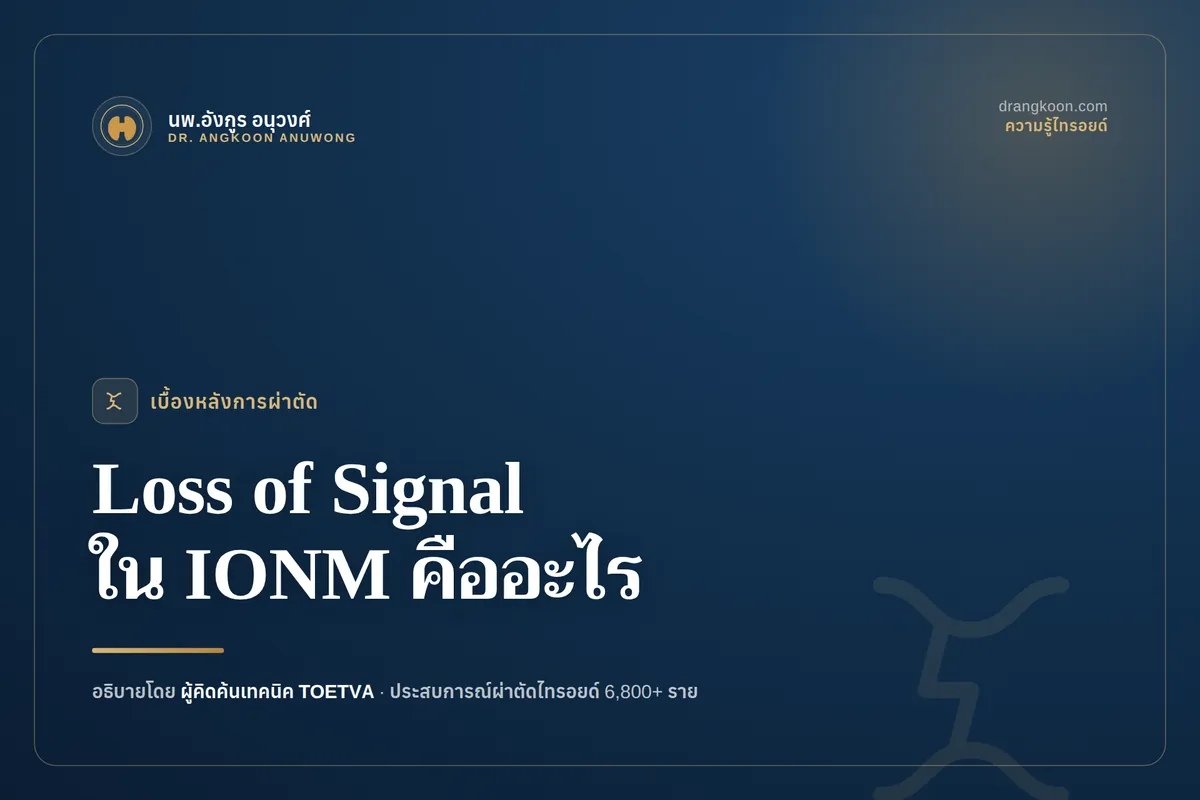 หน้าจอเครื่อง IONM แสดงภาวะ Loss of Signal ระหว่างการผ่าตัดไทรอยด์และขั้นตอนการตรวจหาสาเหตุ
