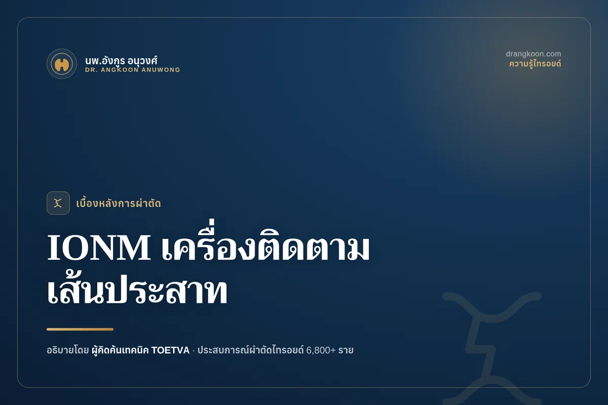 เครื่อง IONM ติดตามการทำงานของเส้นประสาทควบคุมสายเสียงระหว่างผ่าตัดไทรอยด์