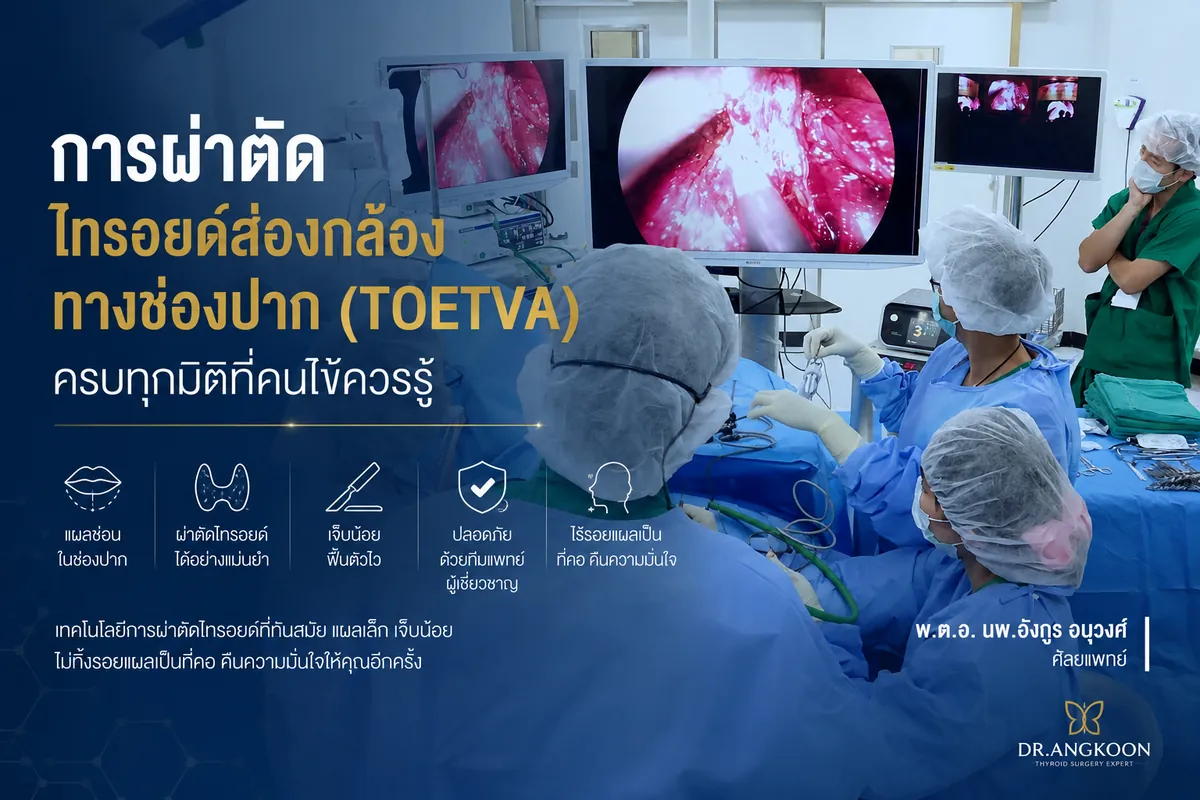 การผ่าตัดไทรอยด์ส่องกล้องทางช่องปาก TOETVA ครบทุกมิติที่คนไข้ควรรู้ โดย นพ.อังกูร อนุวงศ์