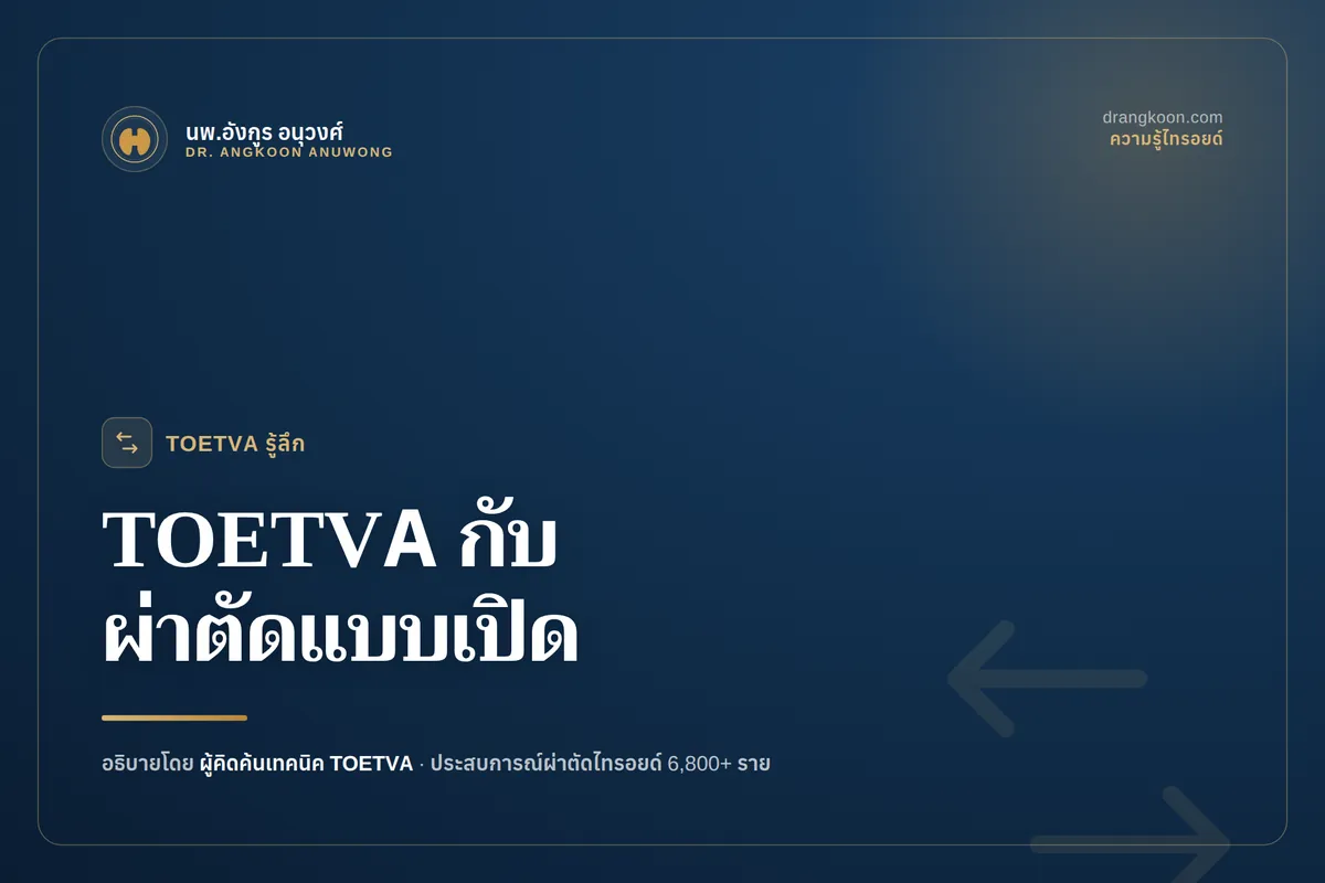 เปรียบเทียบการผ่าตัดไทรอยด์ส่องกล้องทางช่องปาก TOETVA กับการผ่าตัดแบบเปิด