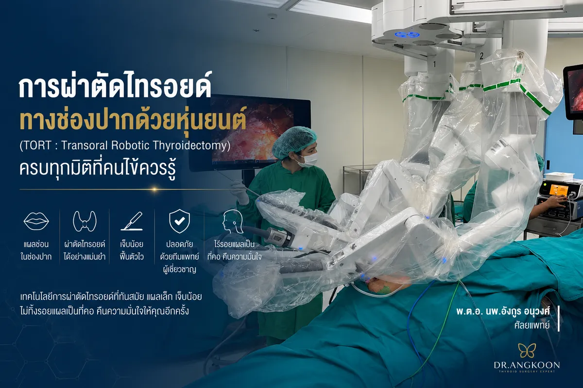 การผ่าตัดไทรอยด์ทางช่องปากด้วยหุ่นยนต์ TORT ครบทุกมิติที่คนไข้ควรรู้ โดย นพ.อังกูร อนุวงศ์